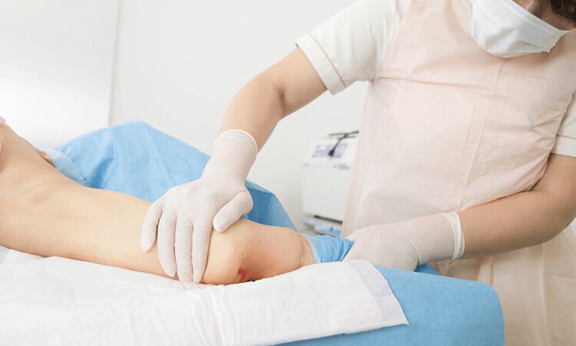 麻酔液の絞り出しイメージ