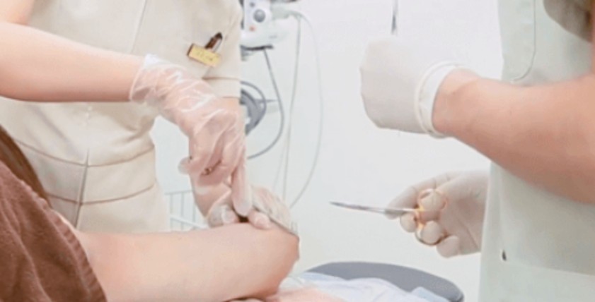 傷口の翌日縫合イメージ